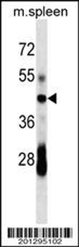 CD79A Antibody (C-term)