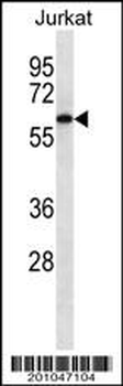 CAMKK2 Antibody