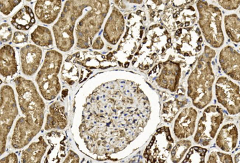 TGFB2 Antibody