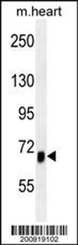 ACVR1B Antibody