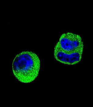 MMP2 Antibody