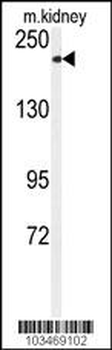 TRPM7 (CHAK1) Antibody (C-term)