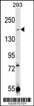 TRPM7 (CHAK1) Antibody (C-term)