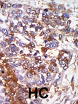 cGKI (cGKI beta) Antibody (C-term)