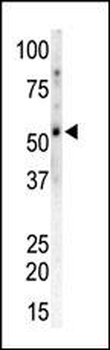 CAMK2G (CAMK2 gamma) Antibody (C-term)