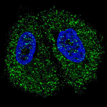 Pyruvate Kinase (PKM2) Antibody (C-term)