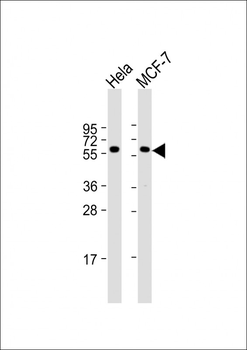Pyruvate Kinase (PKM2) Antibody (C-term)