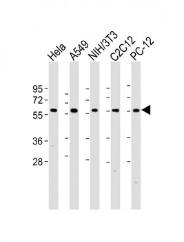 Pyruvate Kinase (PKM2) Antibody (C-term)