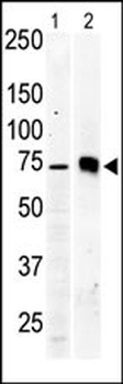 PKC beta2 Antibody (C-term)