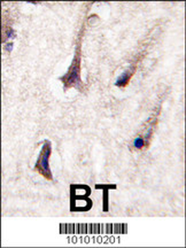 PKC beta2 Antibody (C-term)