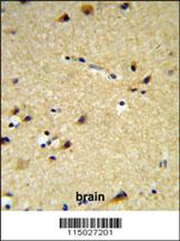 CYP26A1 Antibody (C-term)