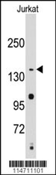 SMC2 Antibody (C-term)