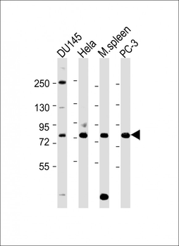 SYVN1 (HRD1) Antibody (C-term)