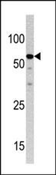 NCAPH2 Antibody (N-term)