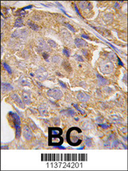 EIF4B Antibody (S422)