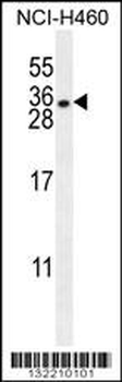 HLA-DQA1 Antibody (N-term)
