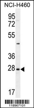 EDN3 Antibody (C-term)