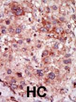 GAK Antibody (N-term)
