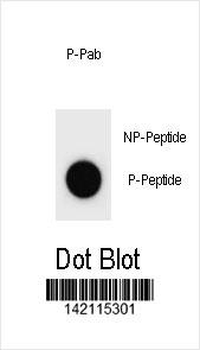 Phospho-mouse p21Cip1(S125) Antibody