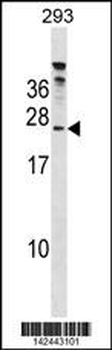 HTATSF1 Antibody (C-term)