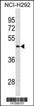 RBMY1A1 Antibody(C-term)