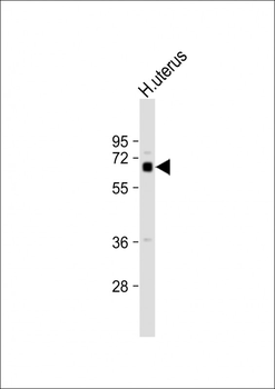 ZFP64 Antibody (C-term)