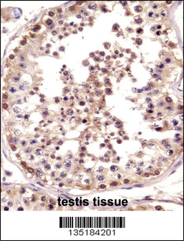TSPY Antibody (C-term)