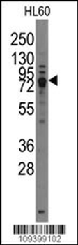 Rat TRPV3 Antibody (C-term)