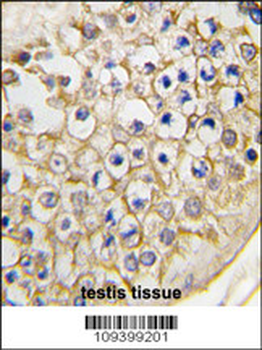 Rat TRPV3 Antibody (C-term)