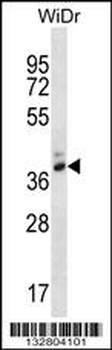 PGA4 Antibody (C-term)