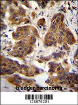 ZGRF1 Antibody (N-term)