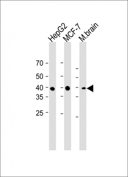 FOLR1 antibody
