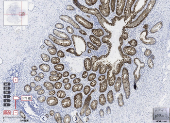 Cytokeratin 20 Antibody