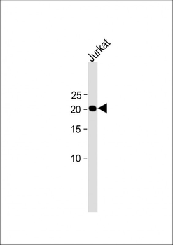 CD3E antibody (C-term)