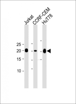CD3E antibody (C-term)