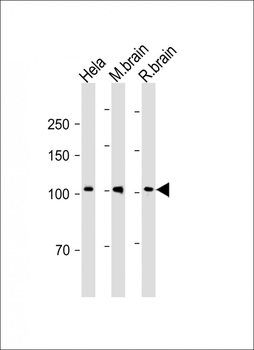NTRK Antibody