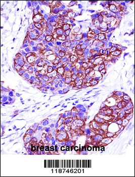CYK18 Antibody (C-term)