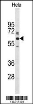 Glypican-1 Antibody (N-term)