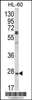 DPPA2 Antibody (N-term)