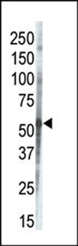 CSNK1G3 Antibody (C-term)
