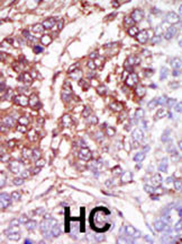 CSNK1G3 Antibody (C-term)