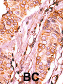 CIT Antibody (Center)