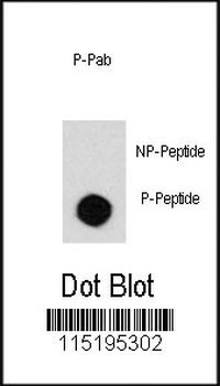 Phospho-Desmin(T16) Antibody