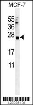 LKAAEAR1 Antibody (C-term)