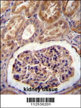 MGP Antibody (Center)
