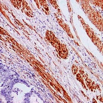 Caldesmon Antibody
