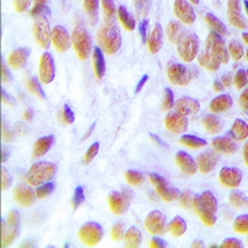 Glucocorticoid Receptor Antibody