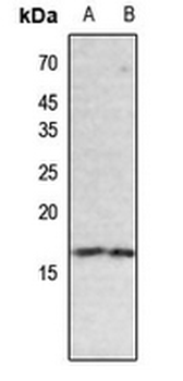 Histone H3 (Butyryl-K18) Antibody