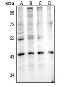 IL-11RA Antibody