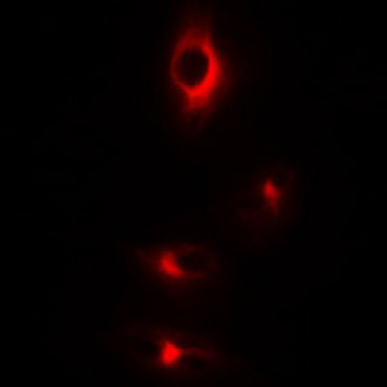 CDC25 (pS916) Antibody